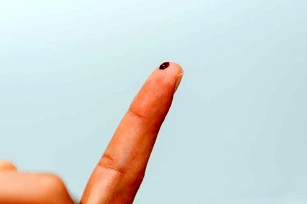 نوک انگشت نشانه های پنهان استرس و اضطراب را آشکار می کند؟