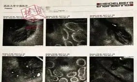 بیماری عجیب زن چینی که 5 سال بالشت خود را نشسته بود