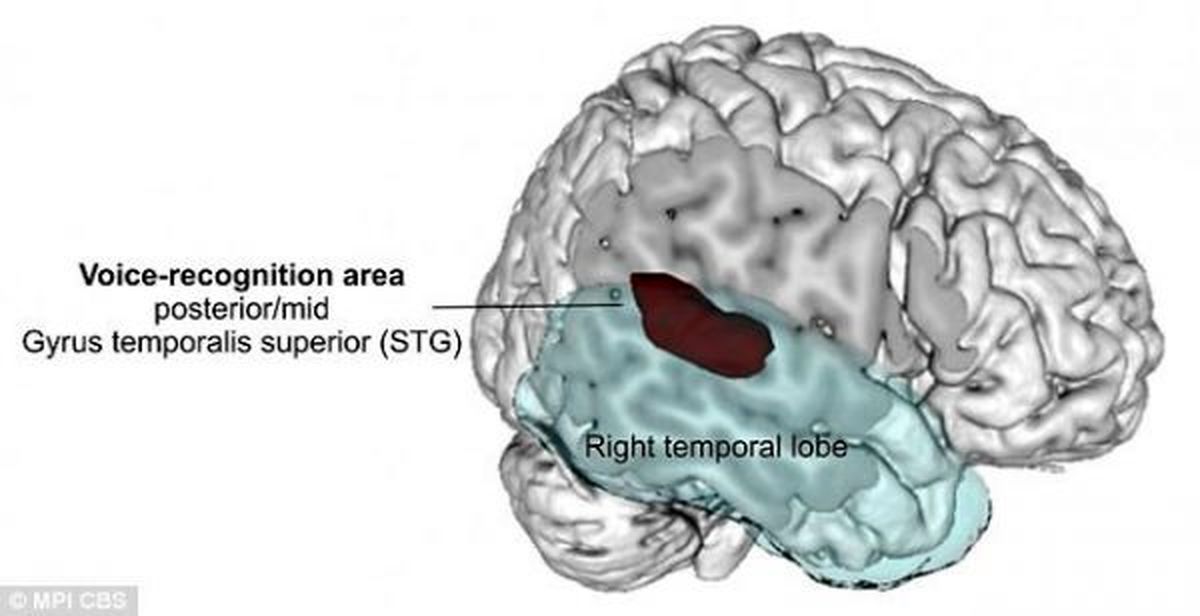 مسئول تشخیص صداها در مغز را پیدا شد