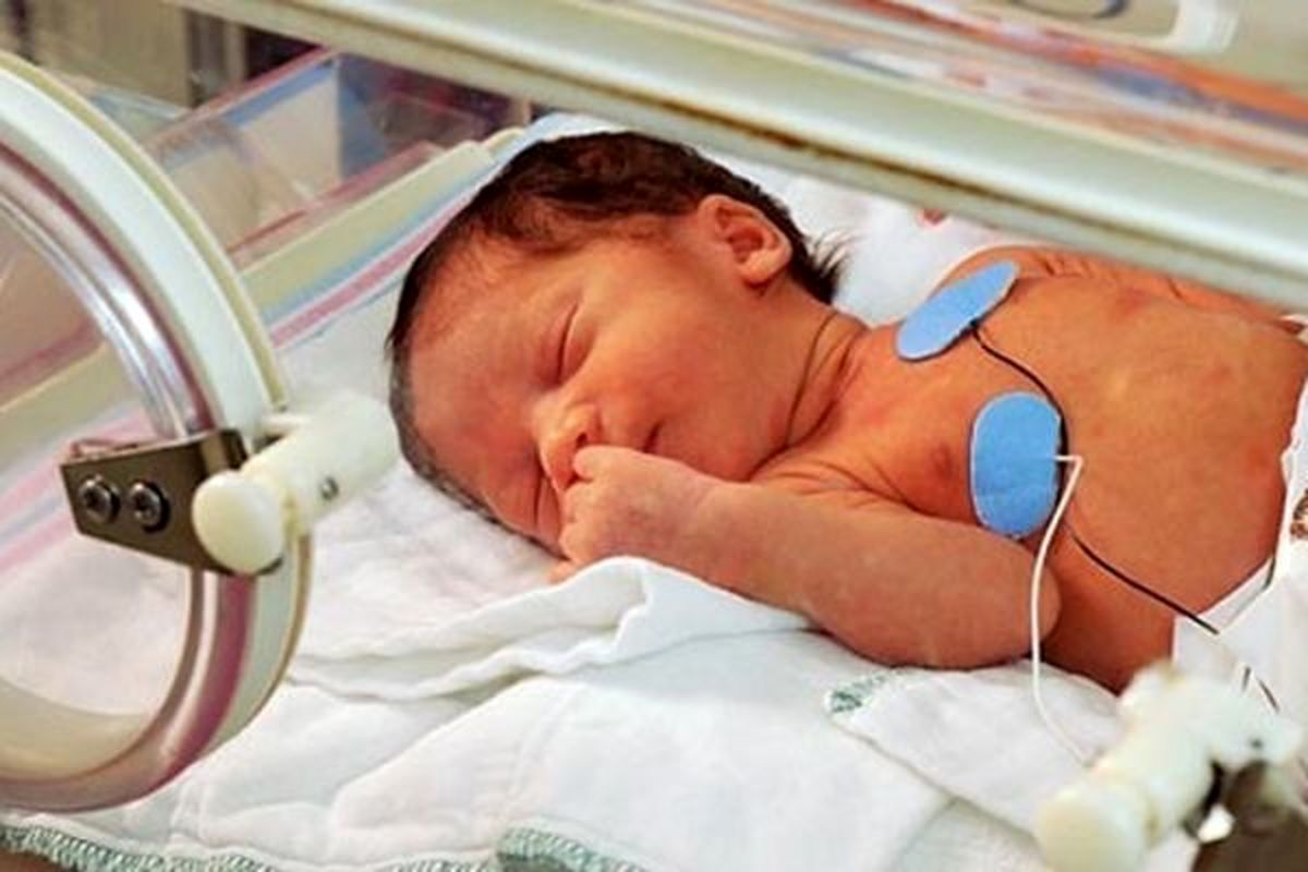 علت تولد پیش از موعد نوزادان در ایران چیست؟