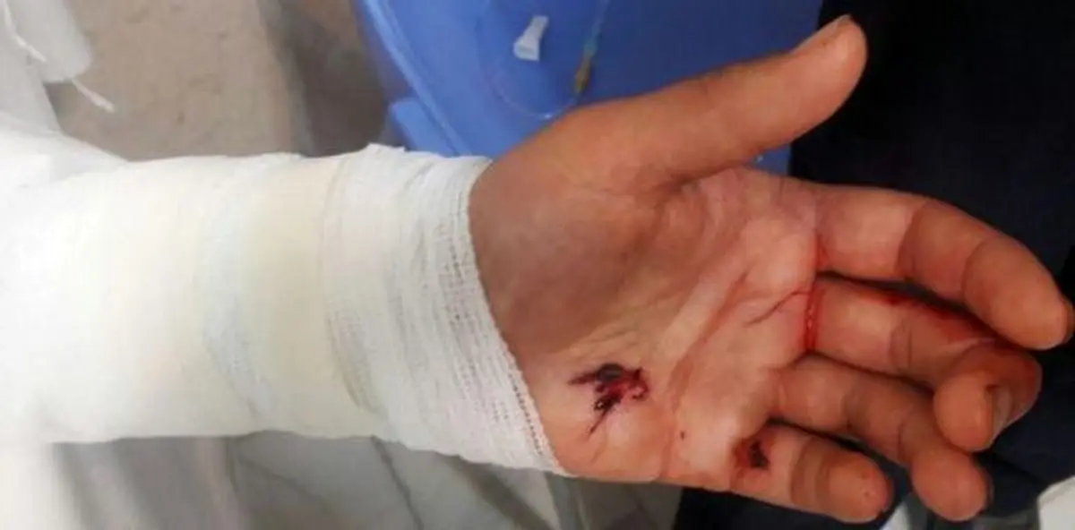 حمله پلنگ به چوپان روستای رستم آباد اردبیل