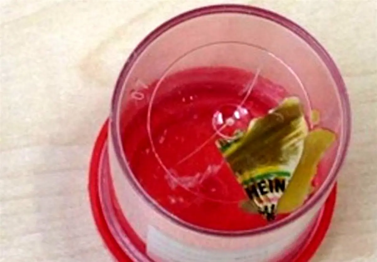 نتیجه عجیب جراحی روی زن ۴۱ ساله + عکس