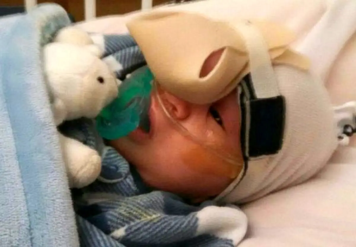 بیماری عجیب یک کودک +تصاویر