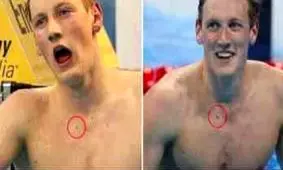 تشخیص سرطان از روی عکس