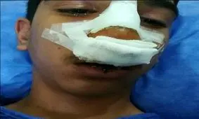 روایت دلخراش کتک خوردن یک دانش‌آموز جیرفتی از دست مدیر مدرسه