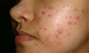 عوامل بدی رنگ و بیماری‌های پوستی