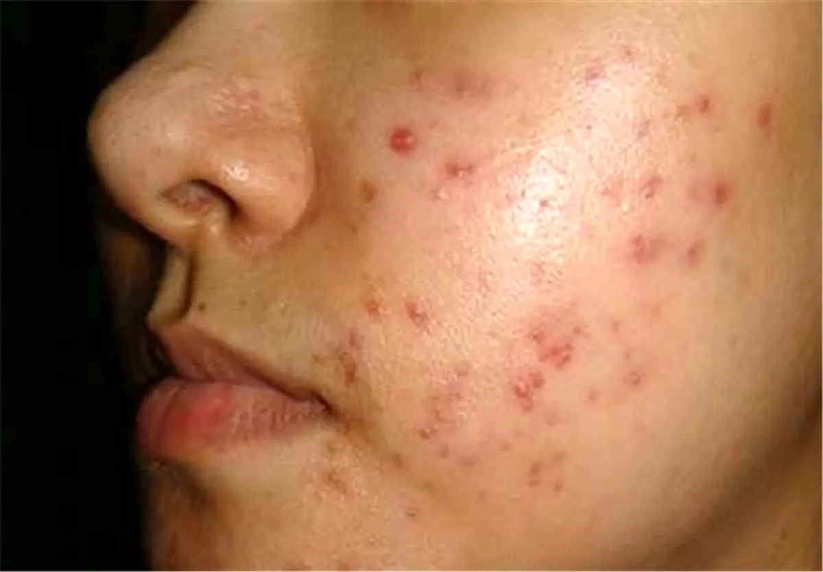 عوامل بدی رنگ و بیماری‌های پوستی