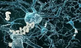 نقش حسگر متابولیک در بیماری آلزایمر