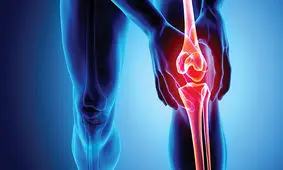 این بیماری خاموش در زن ها را بشناسید