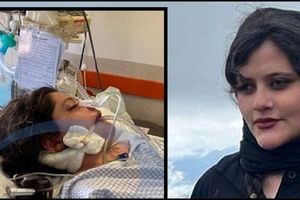 خلاصه پرونده مهسا امینی در بیمارستان کسری به روایت رادیو گفتگو