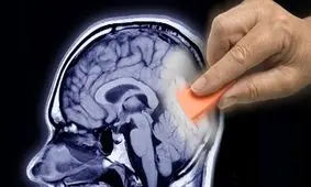 آلزایمر در کمین این افراد است!