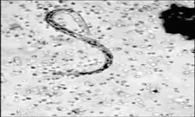 حمله گلبولهای سفید به انگل + ویدئو