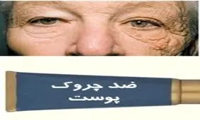 10 نکته درباره کرم‌های ضدچروک !