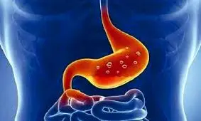 عوامل «ریفلاکس» و «ترش کردن» معده