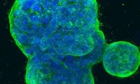 ساخت دارویی جدیدی برای سرطان سینه