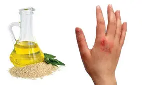خواص روغن کنجد برای سوختگی و سایر بیماری‌ها