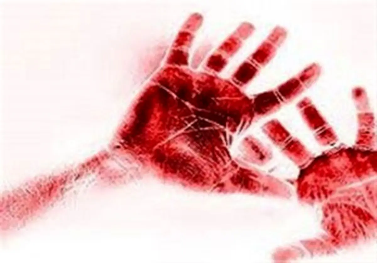 ضربات شلنگ بر بدن کودک 7 ساله