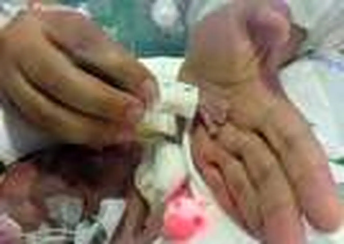 نوزادی به اندازه سیب!