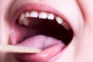 بیمارى وحشتناک که بیخ گلویتان چسبیده است +علل ابتلا به سرطان زبان