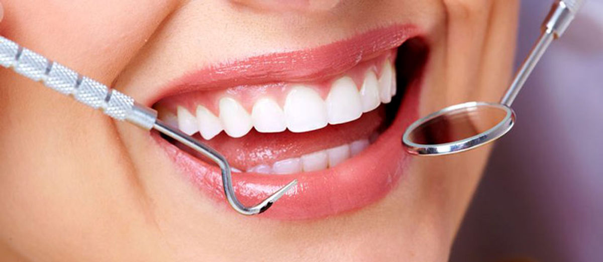 از بین بردن پلاک دندان با ۱۵ روش ساده و کاربردی