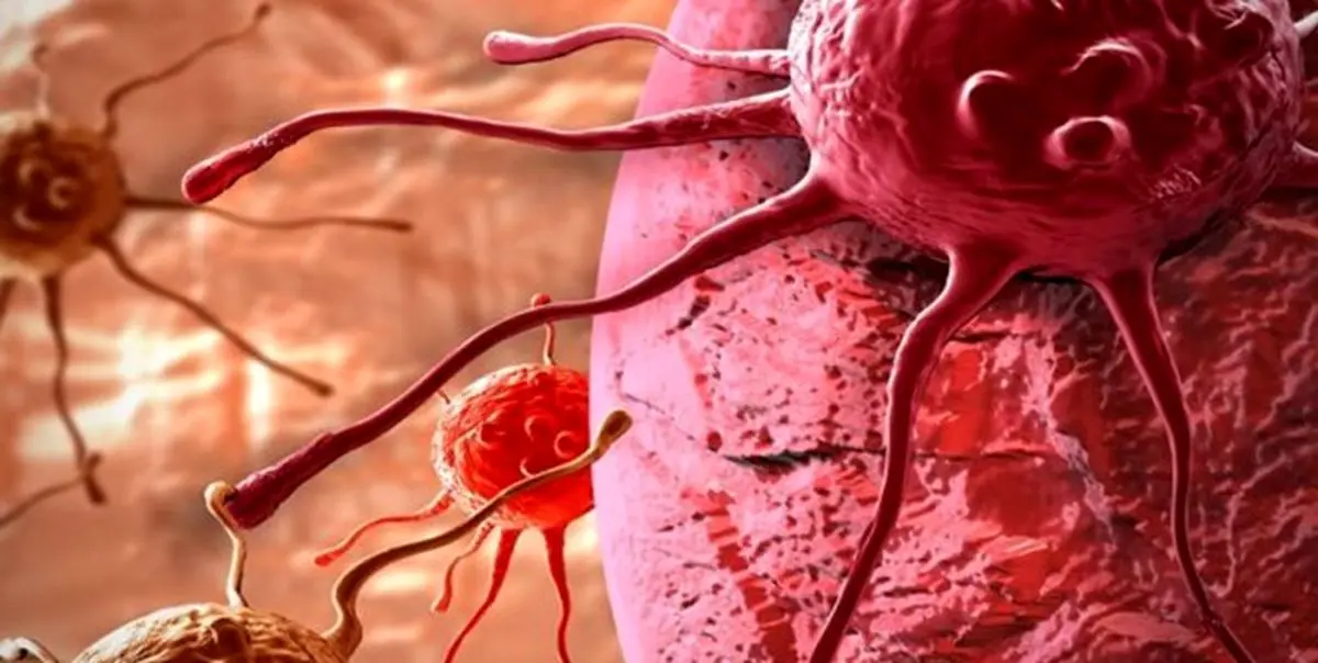 جدیدترین روش های درمان سرطان به وسیله «رادیو تراپی»