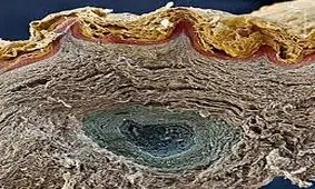 پوست انسان زیر میکروسکوپ!+فیلم