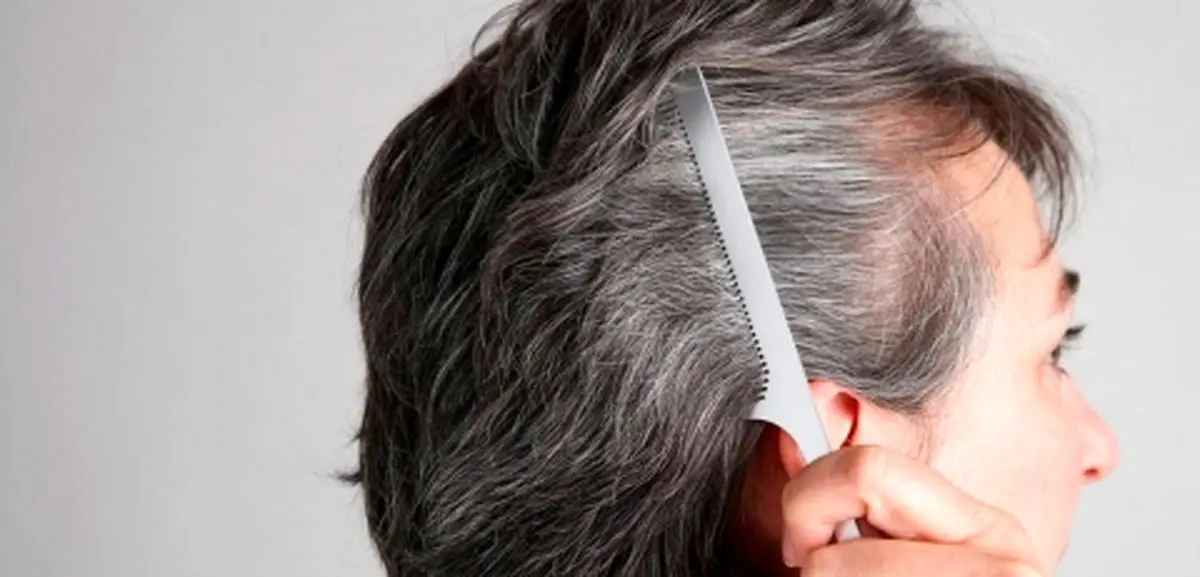 جلوگیری از سفید شدن مو با ۱۰ ماده‌ای که شما را جوان‌‌تر نگه می‌دارد