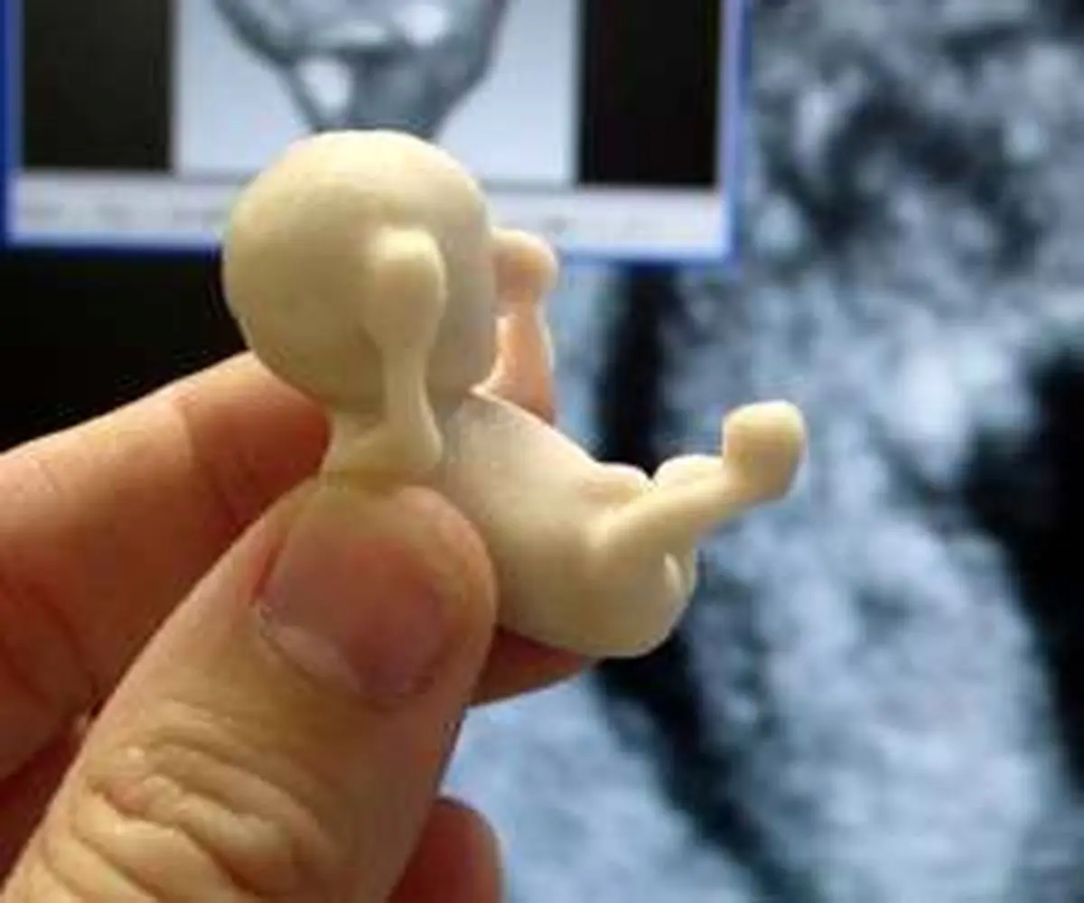 علت ، علامت و درمان قطعی بچه خوره یا حاملگی پوچ