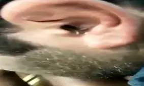 خارج کردن هزار پا از گوش