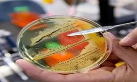سازمان جهانی بهداشت فهرست ۱۲ باکتری خطرناک را منتشر کرد