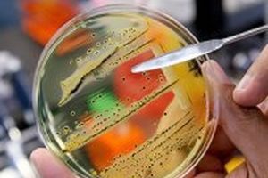 سازمان جهانی بهداشت فهرست ۱۲ باکتری خطرناک را منتشر کرد