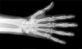 بدنتان را اسکن کنید، جایزه نقدی بگیرید! + جزئیات