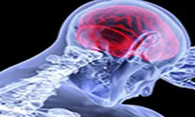 رابطه چاقی و کوچک شدن مغز