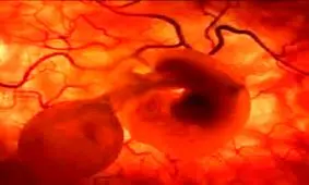 لکه بینی در بارداری، طبیعی است؟