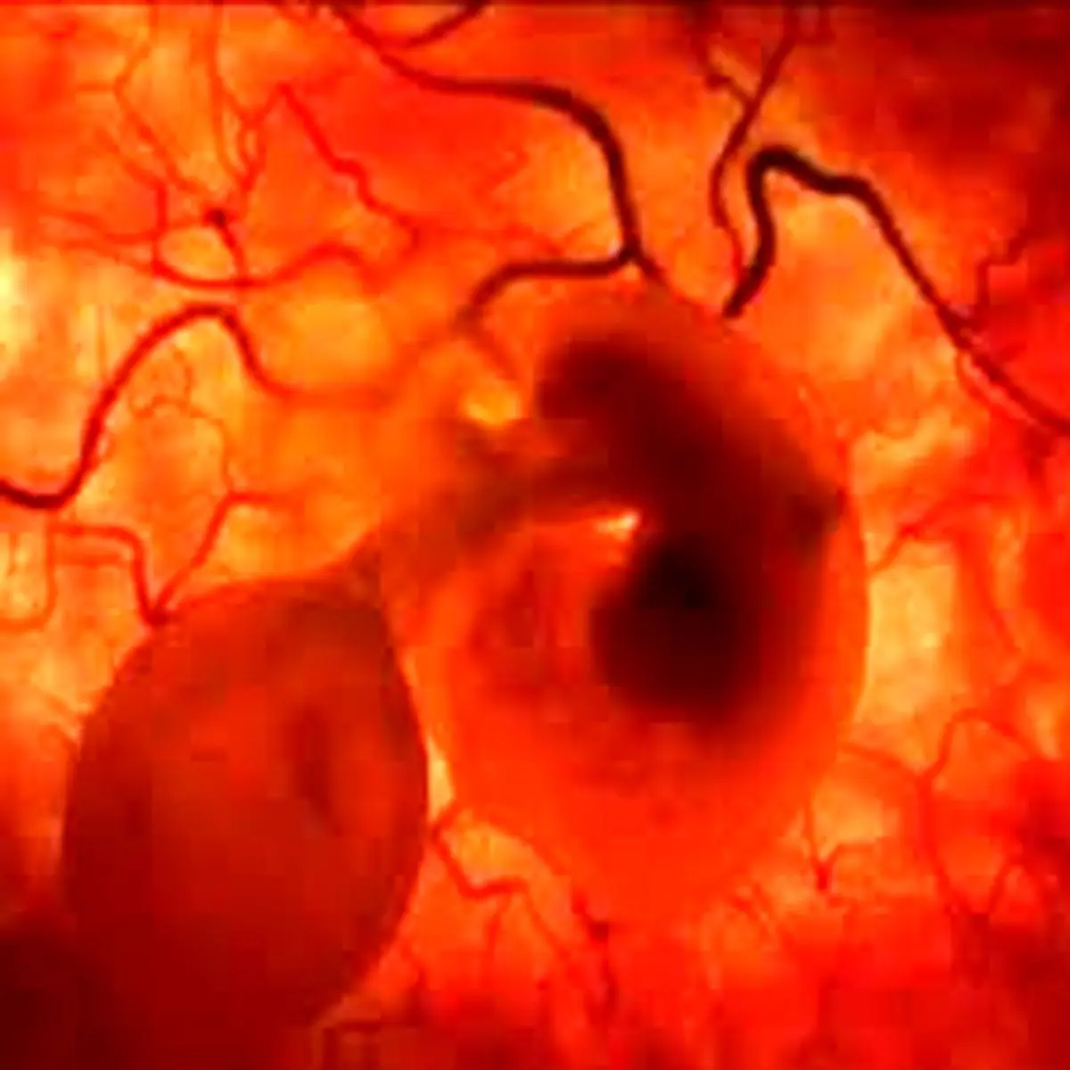 لکه بینی در بارداری، طبیعی است؟