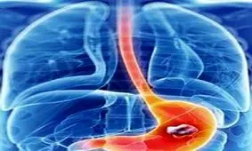 سرطان لوزالمعده در صدر سرطان‌های کشنده