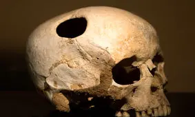 استفاده عجیب و غریب از جمجمه که باورتان نمی‌شود!