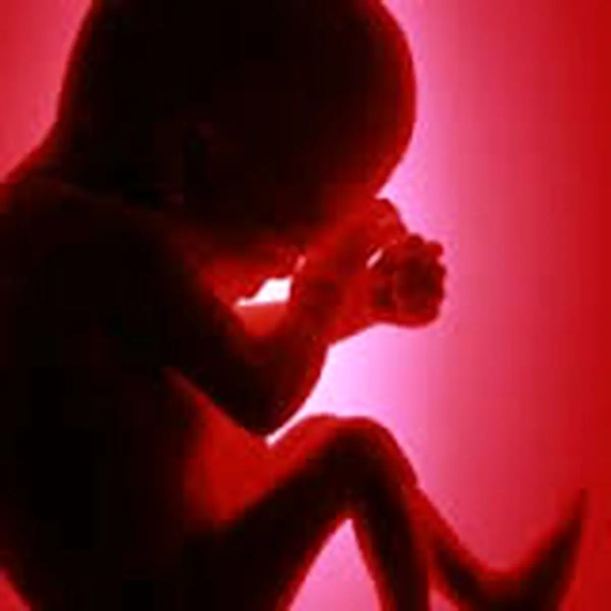 اجازه سقط «جنین مبتلا به تالاسمی شدید»/ لزوم انجام آزمایش ژنتیک