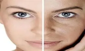 درمان بیماریهای پوستی با استفاده از گیاهان دارویی