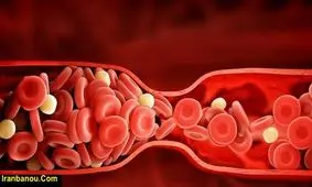 تصفیه خون با 7 غذای گیاهی