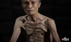 زخمهای ناکازاکی همچنان تازه است