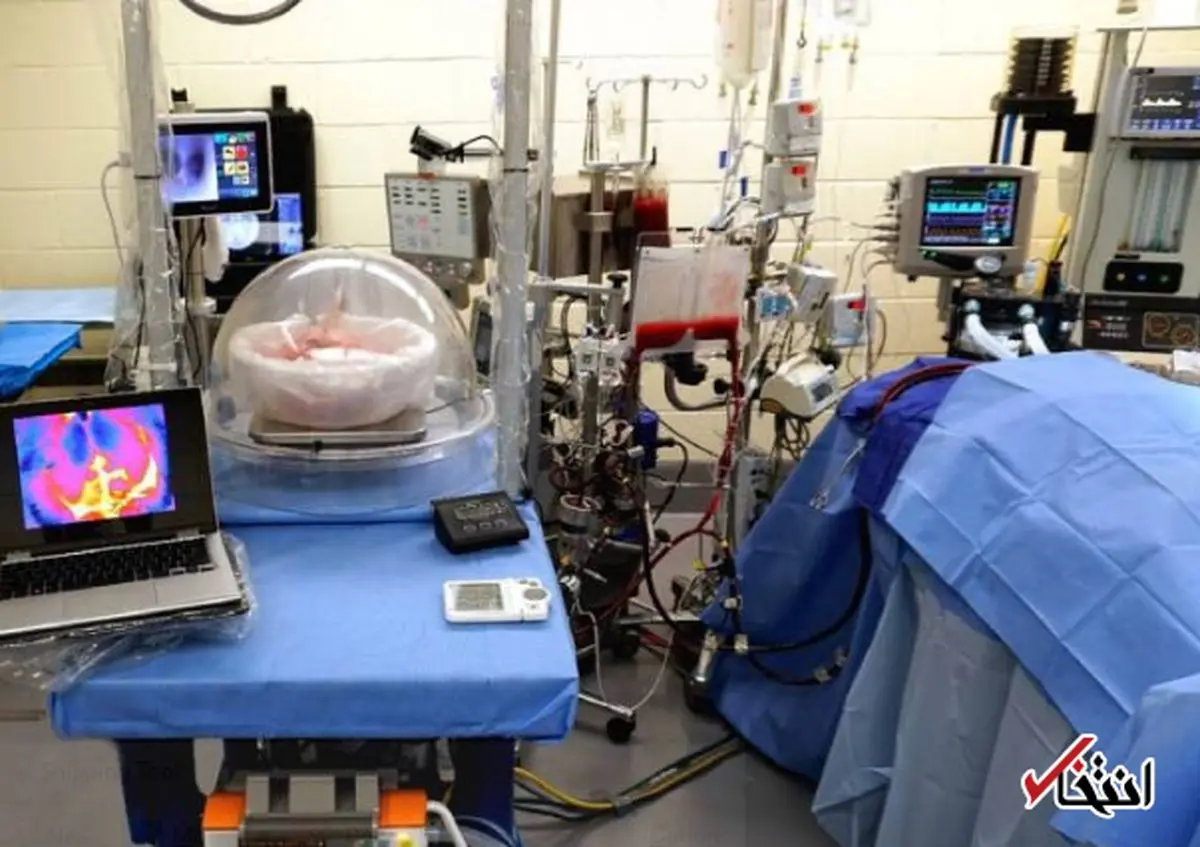 ریه ای که خارج از بدن کار می کند!