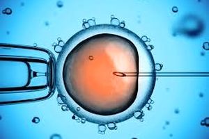 IVF و ICSI درمانی برای ناباروری‌های مردانه