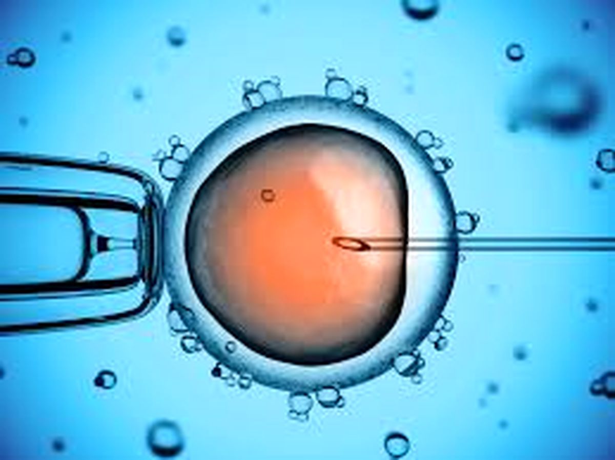 IVF و ICSI درمانی برای ناباروری‌های مردانه