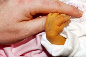 علت یرقان در نوزادان، رنگش شده عین زردچوبه