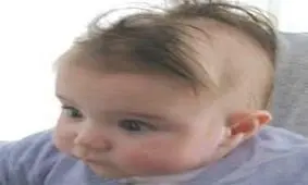 علت ریزش مو در کودکان، کچل نشه؟