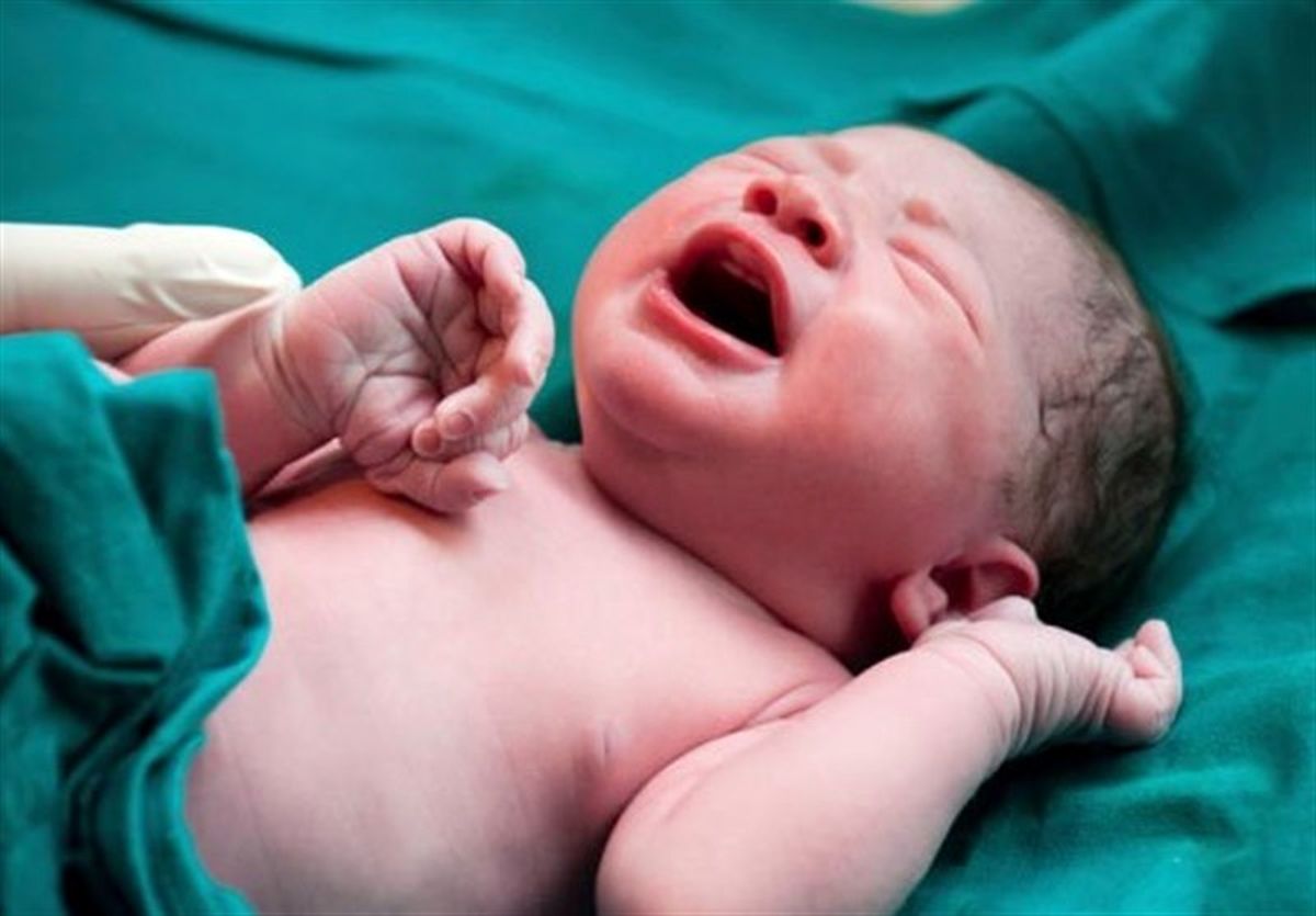 تولد نوزادی در گراش که قلبش در سمت راست بدن قرار دارد