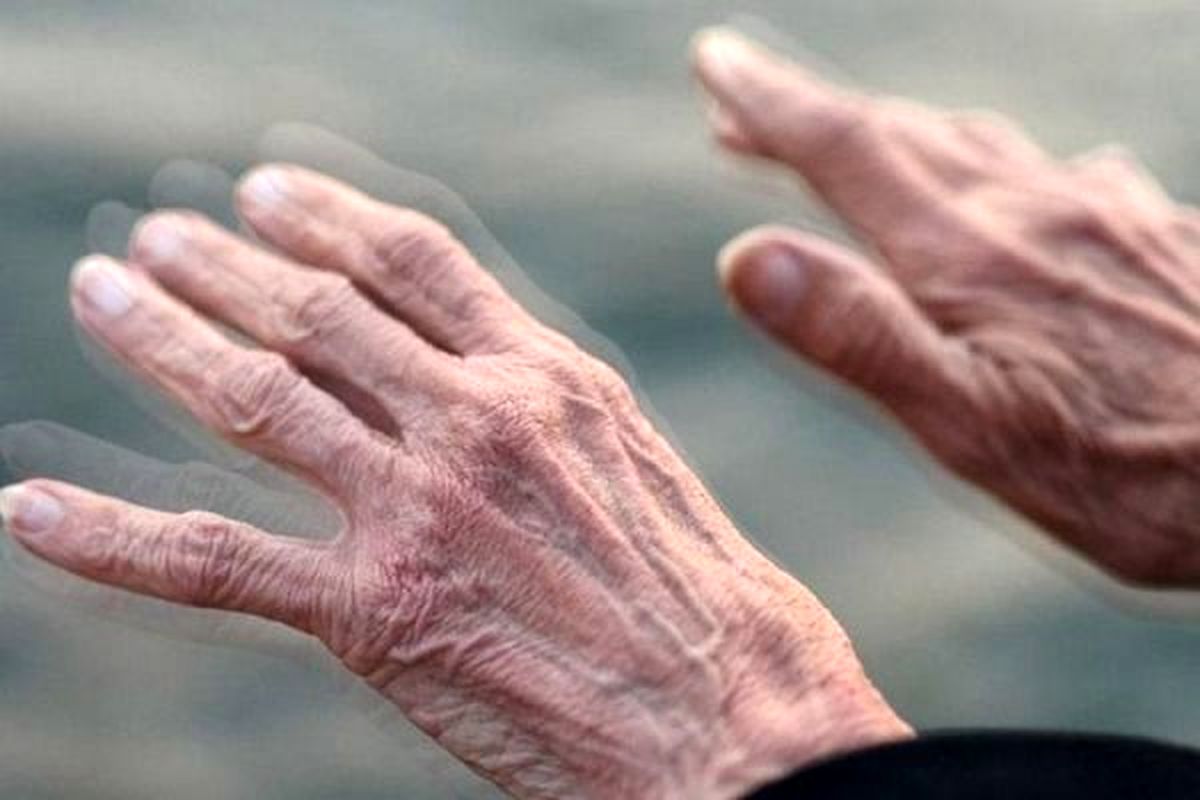 تشخیص پارکینسون 20 سال زودتر از بروز علایم آن