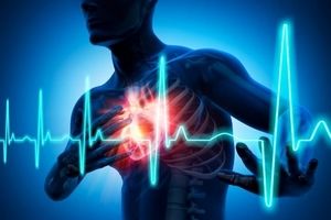 بیماری‌های قلبی عروقی صدرنشین علل وقوع مرگ‌های زودرس