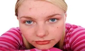 جوش ها دقیقا به ما چه می گویند ؟